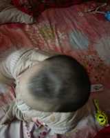 子宫内膜异位症备孕经历分享：从中医调理到自然受孕的旅程