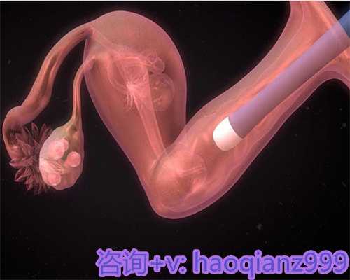 北京试管促排方案及医院选择指南