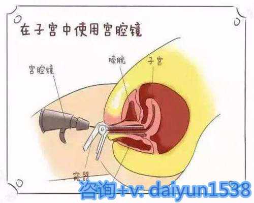 2026年三代供卵试管医院名单及费用解析