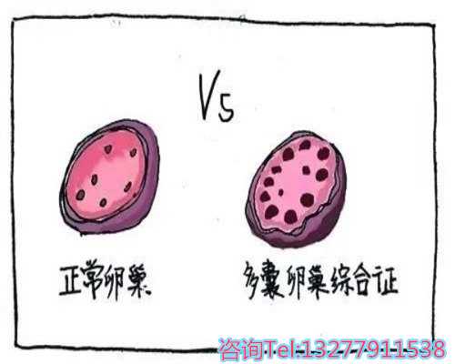 北京助孕机构解析乌克兰试管医院排名与辅助生殖指南