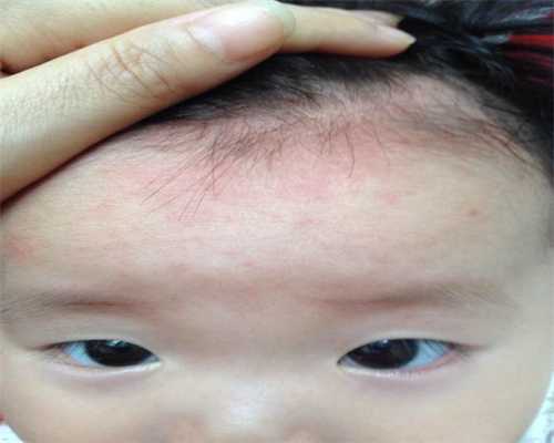 试管技术代生孕机构中1b2b3b的区别解析