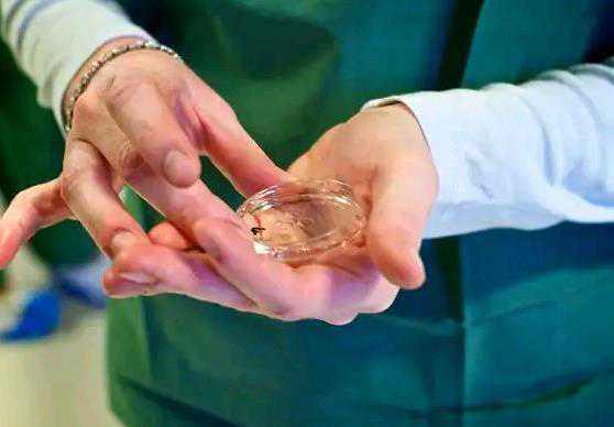 高龄失独家庭试管助孕医院选择与费用指南